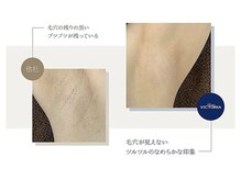 タスク(Tasuku.)/一部からでも脱毛歓迎！