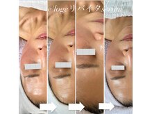 リュミエール(Lumie're)/しわケア