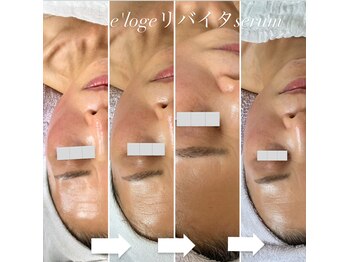 リュミエール(Lumie're)/しわケア