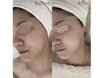 コアラッシュ(COA LASH)/タラソトリートメント