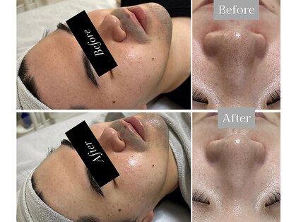 ザセイム(THE Same)の写真