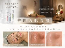 ダイヤモンド リーエンダ(Diamond leende)