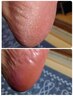 【フットケア】角質除去のみ