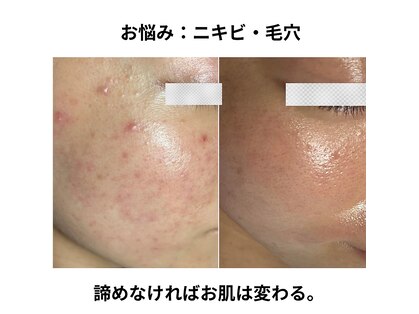 スパークルの写真