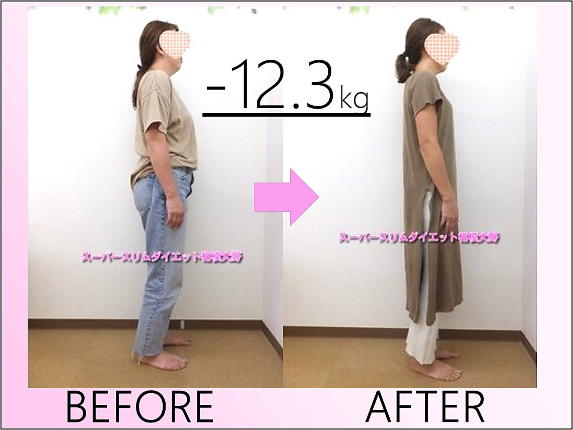 スーパースリムダイエット 相模大野｜ホットペッパービューティー
