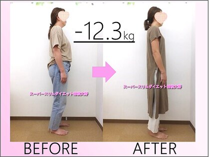 スーパースリムダイエット 相模大野の写真