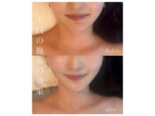ベルシア(BELXIA)の雰囲気（加工不要！全身＆小顔激変。BELXIA独自の“造顔矯正”メソッド）