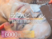 ジュエル(jewel)