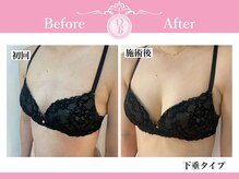 デミーナ(Demyna)/