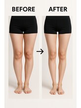 ビテ(Bite)/20代　会社員