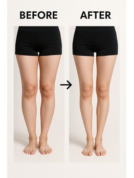 ビテ(Bite)/20代 会社員