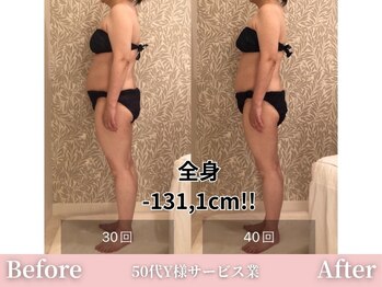 アメリイ 百合ヶ丘 新百合ヶ丘(Amerii)/【痩身】全身-131,1cm痩せました