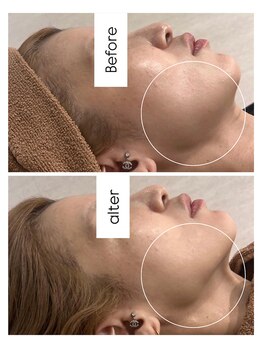 リリー 一宮店(Lily)/IT LIFT【30代】