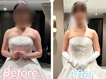 ヒデ整体院(Hide整体院)/ブライダルエステ(美容整体)