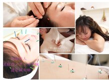 美容鍼ならRe.庵/お身体の鍼灸/ストレス鍼灸/全身ケアするサロン