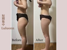 ヨサパーク デイジー(YOSA PARK Daisy)/痩身/よもぎ蒸し/リンパ/毛穴