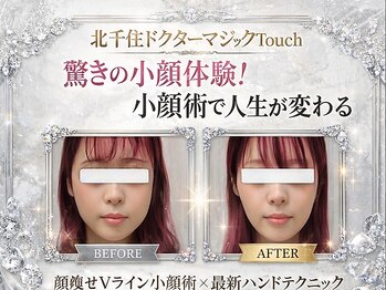 ドクターマジックタッチ(Dr.MAGIC TOUCH)/劇的変化/解剖学×Vライン小顔