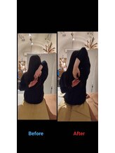 アールプラス(R+)/肩こりでお悩みの方へ