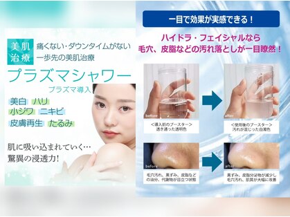 チル アウト(CHILL OUT)の写真