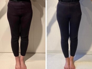 ザ エスアップ 博多店(THE S-UP)/施術前後写真