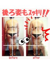 ビューティサロン キヨの部屋(beauty salon)/【筋膜リリース】 １回