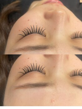 ビュー(V.I.E.W)/FLATLASH１００本