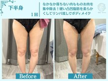 フローフシ∞/【痩身】下半身・お尻の脂肪撃退