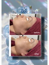 プリマプリート 各務原店/グレーズソフトピール