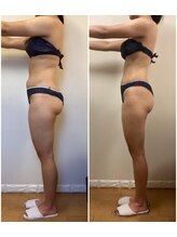 ルピナージュ(Lupinage)/ビフォーアフター