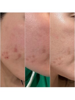 アイクイーン 亀戸(Eyequeen)/