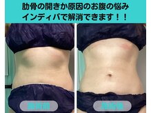 ナナ 銀座(Nana)/肋骨の開きはインディバおすすめ