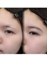 チルアンドアイ 千葉駅前店(Chill&Eye)/美眉スタイリング/BeforeAfter