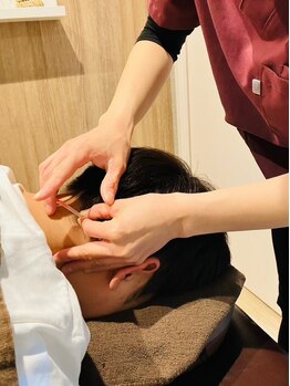 アオイ(aoi)の写真/あなたの美しさを引き出す美容鍼！完全個室で、くすみやシミ、たるみを改善しませんか♪初めての方にも◎