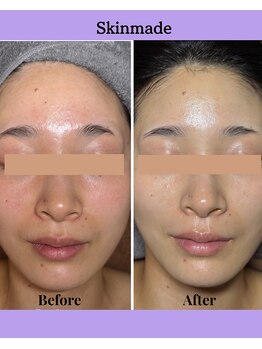 ラ ジェム(La gemme)/【トロイアルケ】