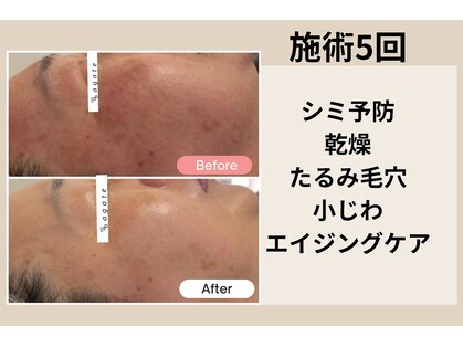 アガットバイミヤモト(agate by miyamoto)の写真