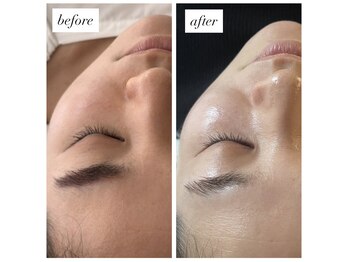 ミミ(mimi)/半年後の変化