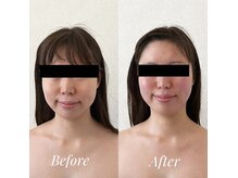 首肩のコリや頭皮のコリもケアする結果重視の小顔ケア