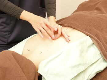 浦和のあ鍼灸整骨院/はり・きゅう