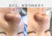 エステティックサロン シーズ