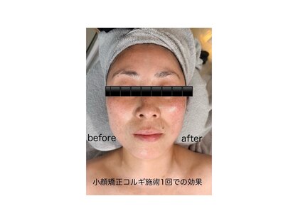 アジュ(Aju)の写真