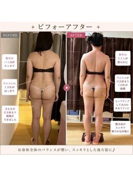 ケイビューティ(k-beauty)の写真/１５年ベテラン在籍/リピート率90％越え♪-10キロ成功者続出☆インディバ/痩身/東新宿/k-beauty
