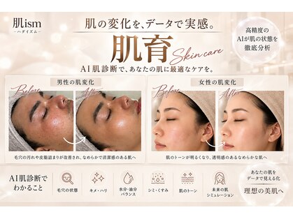 肌イズム つくば店(肌ism)の写真