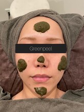 アズ(A's)/グリーンピール