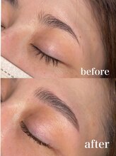 ボアップ 松山店(boappu)/形のお悩み改善