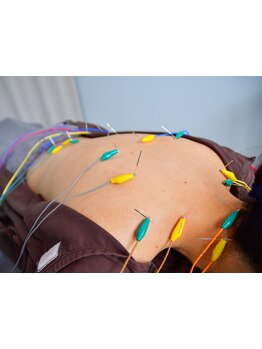 鍼灸施術を受けたい