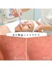 【圧倒的毛穴洗浄】全顔ハイドラフェイシャル＆剥離なしピーリング＆導入ケア