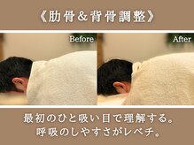 リカバリア(Recoveria)/肋骨＆背骨調整