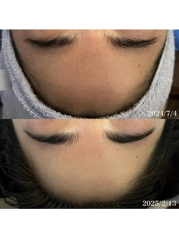 リリアス(RILLIAS)/くすみケア