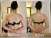 一般的な整体や機器では解決できない側湾の方へ。『駆け込み寺』