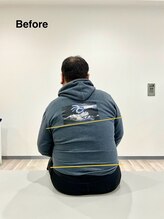 みずき/体の歪み施術前